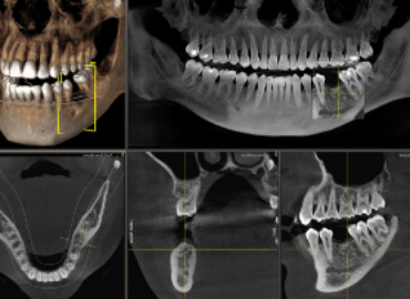Savremena radiologija u korist stomatologije
