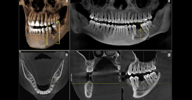Savremena radiologija u korist stomatologije